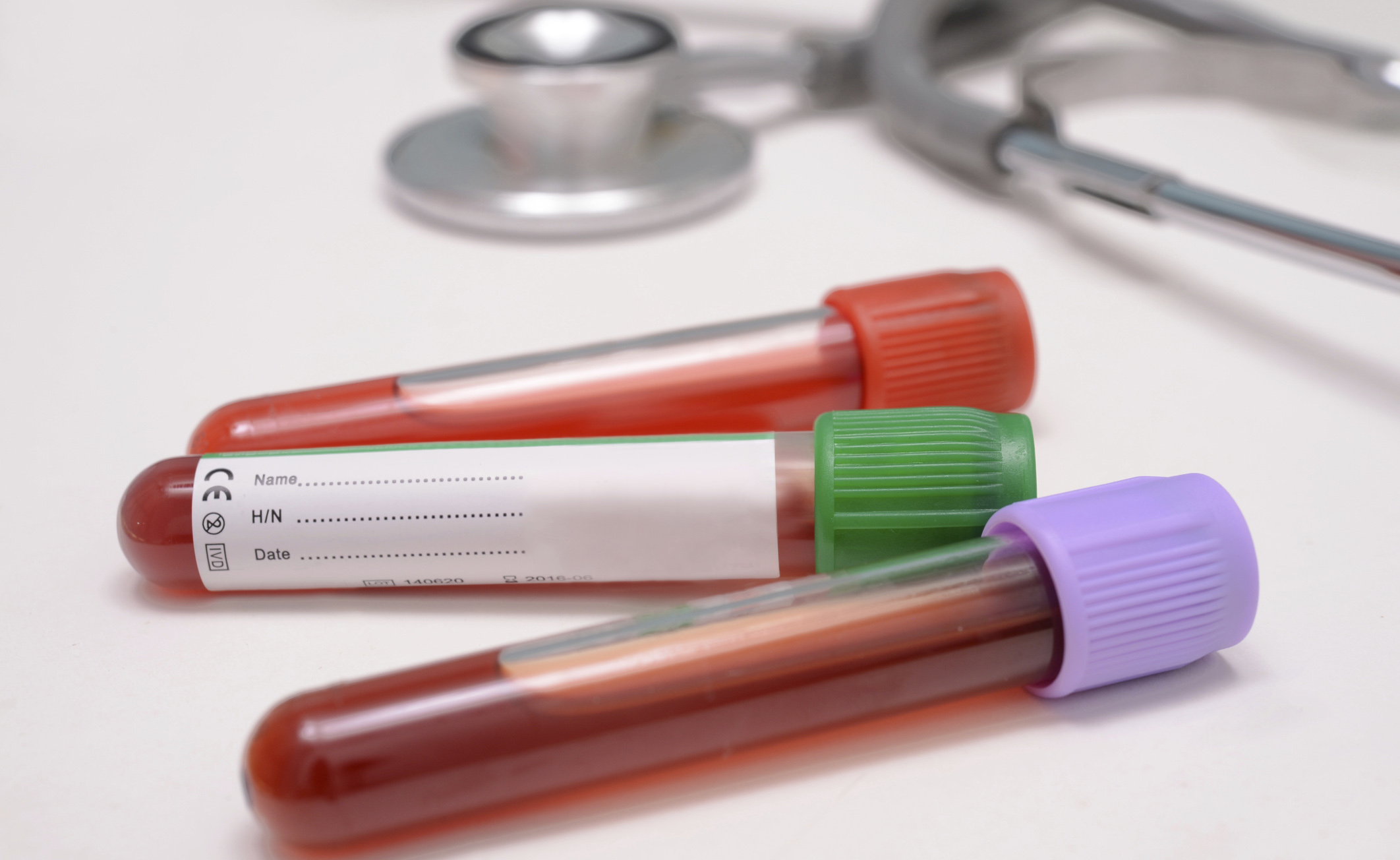 Ferritina alta no sangue dieta