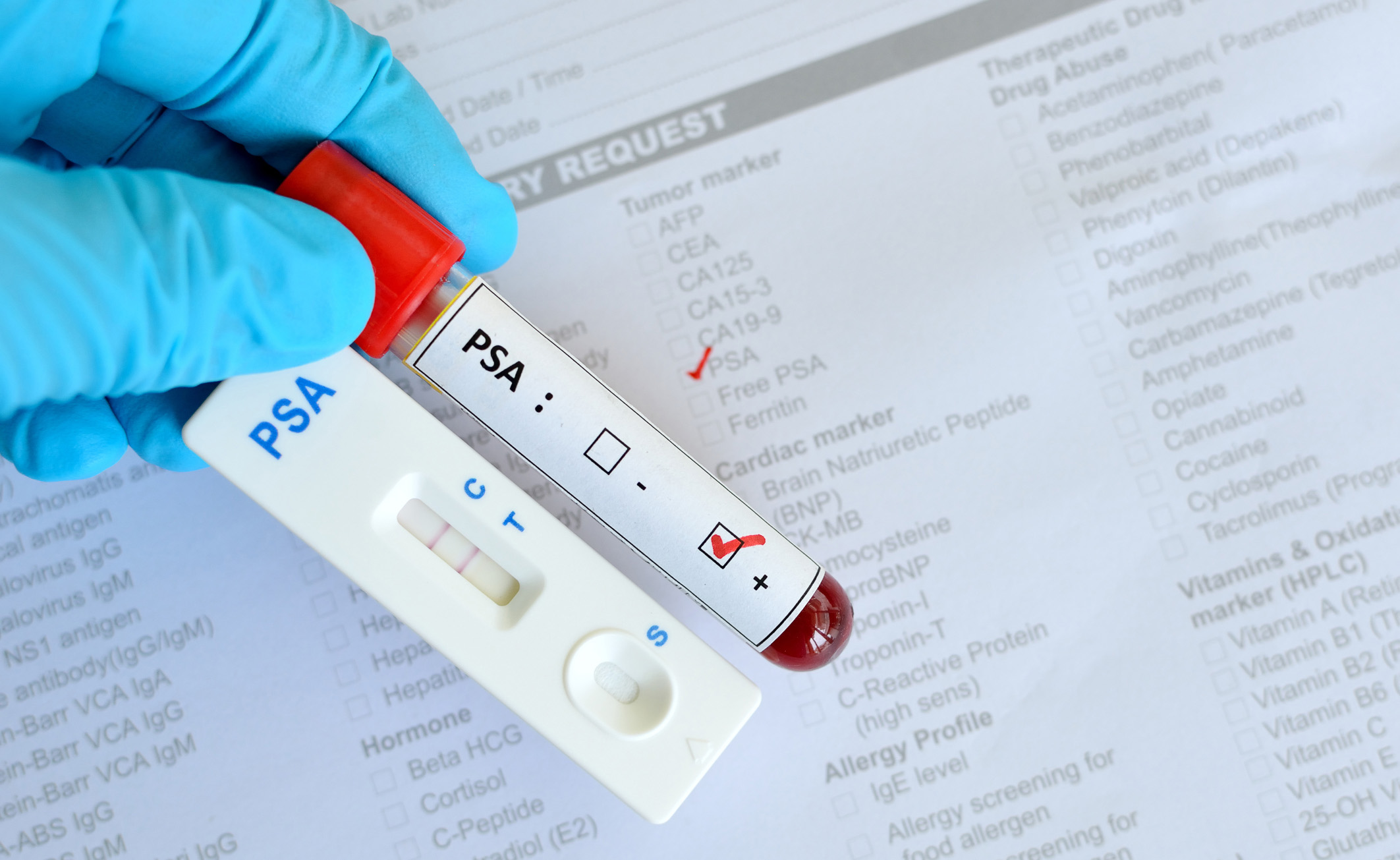 test psa gratuito per il cancro alla prostata test psa gratuito per il cancro alla prostata