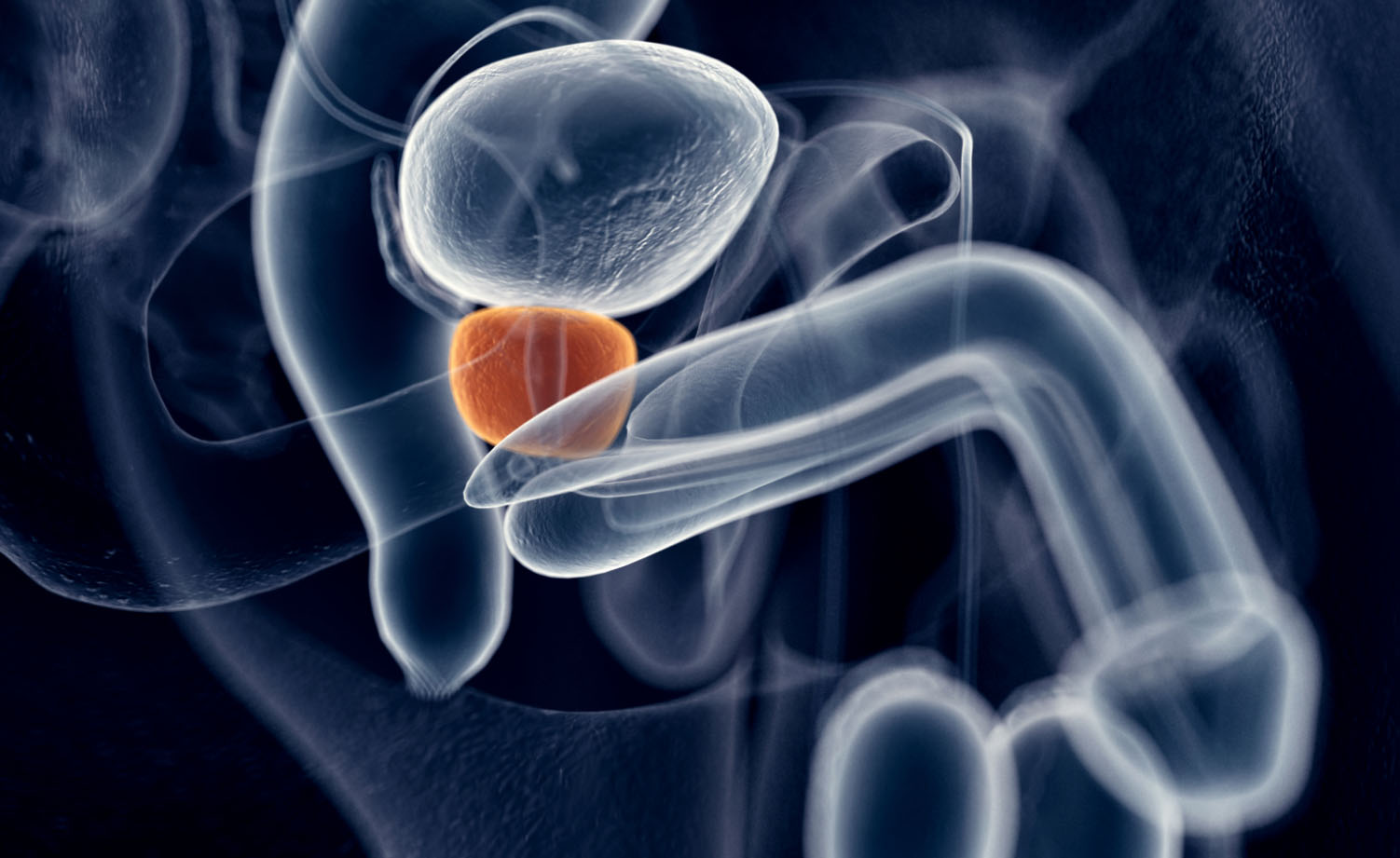 terapia per tumore prostata