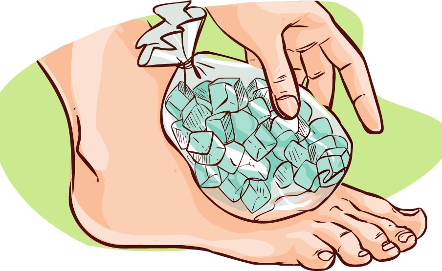 curare il carcinoma alla prostata col ghiaccio