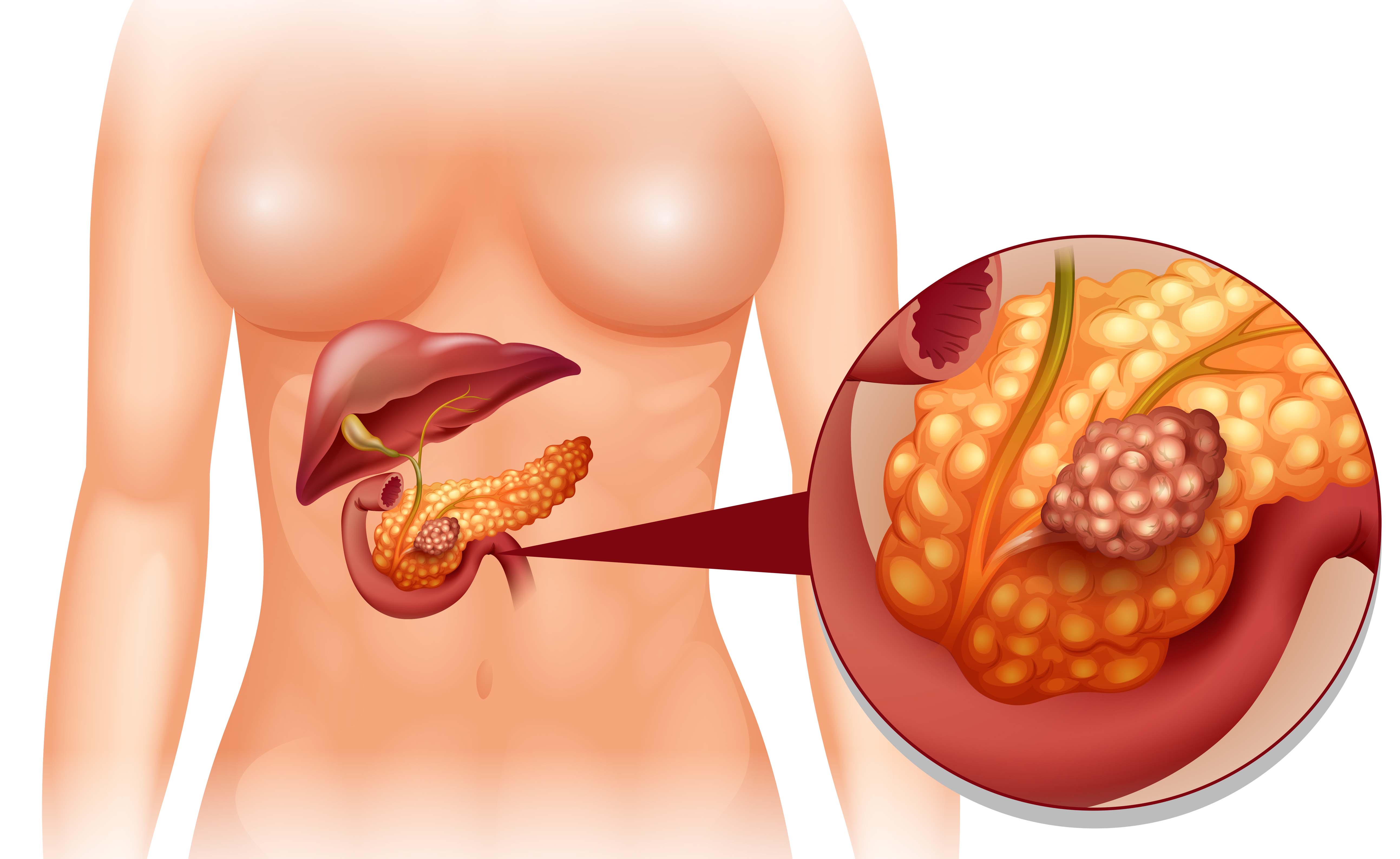 mal di stomaco e urine giallo scuro