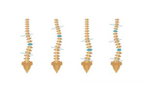 dimorfismi e paramorfismi: come fare a prevenirli
