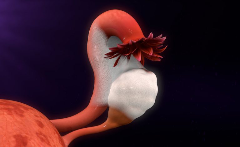 dolore pelvico con iud