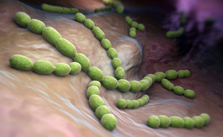 La polmonite può essere una complicanza dell’influenza?