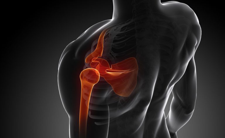 cancro alla prostata dolore alle articolazioni dellanca