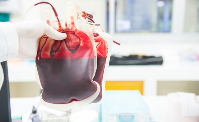 ferritina alta e prostata ferritina alta e prostata