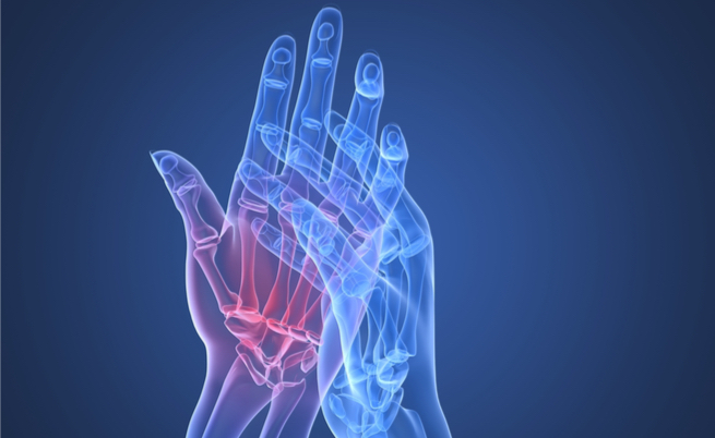 Simptomele osteochondrozei ?i forumul de tratament