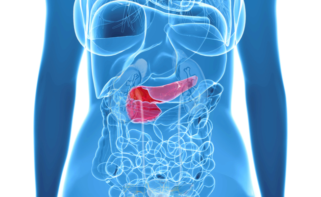 Tumore al pancreas: un test per la diagnosi precoce
