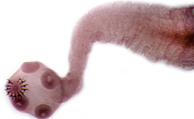 I vermi che infestano il cervello