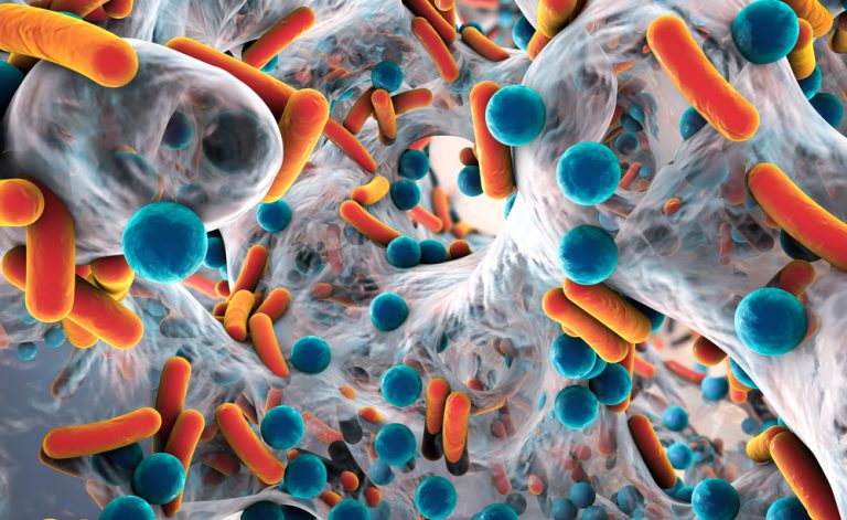 Come distinguere un’infezione virale da una batterica