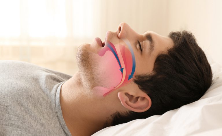 5 modi per riconoscere le apnee notturne