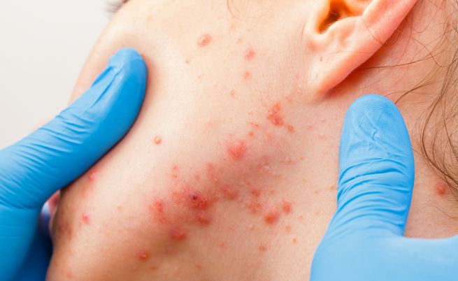 Le 5 cose che un dermatologo non metterebbe mai sul suo viso
