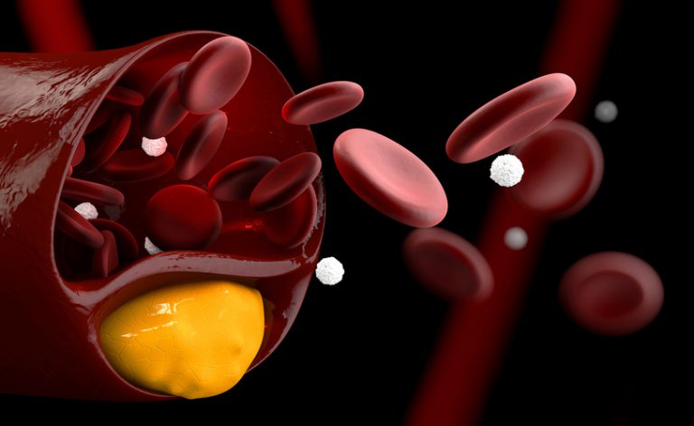 Esami per il cuore e per il metabolismo: ecco come leggere le analisi del sangue