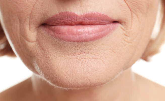 Collagene: i rimedi naturali per stimolarne la produzione (e dire addio alle rughe)