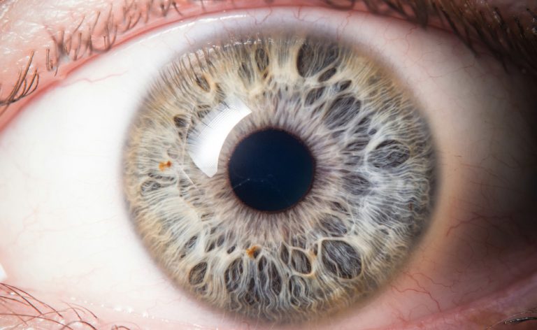 Autismo e diagnosi precoce: un test sulle pupille può predirlo?