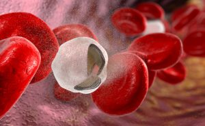 anemia: quando è necessaria una Trasfusione