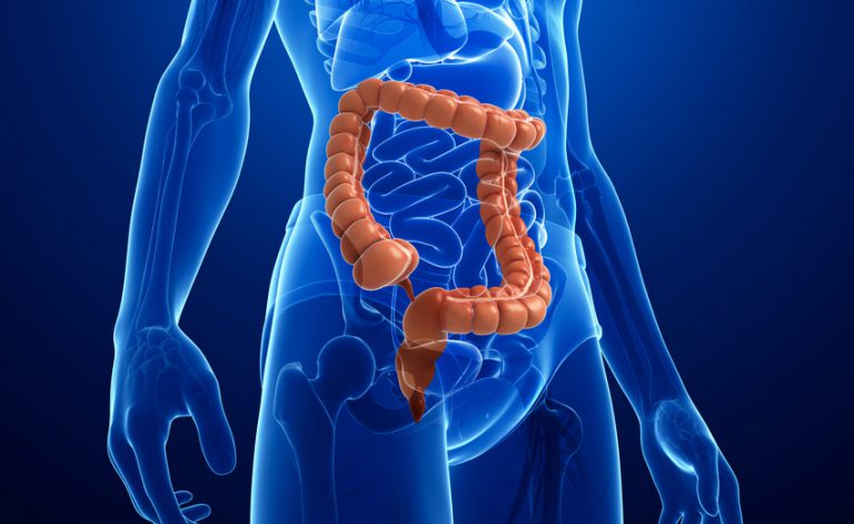 Flatulenza continua: come riconoscere le cause per tornare ad avere una pancia piatta