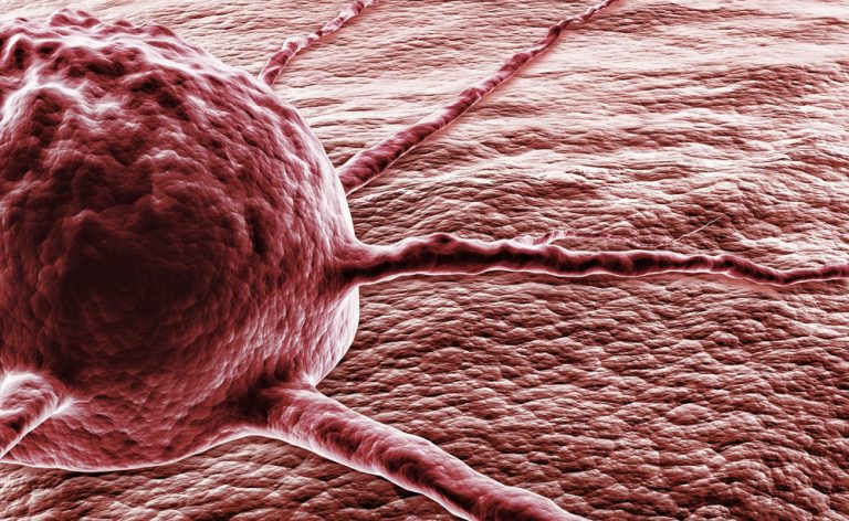 Tumore al colon retto e biopsia liquida: una nuova arma contro la malattia