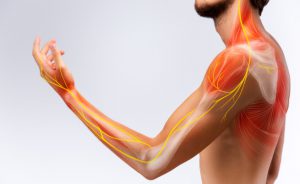 elettromiografia: per valutare la salute di muscoli e nervi
