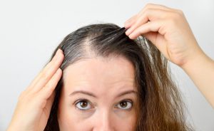 stress e capelli bianchi: qual è il legame?