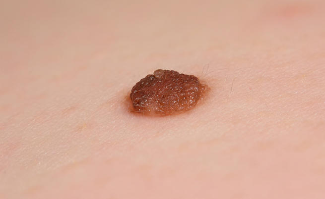 Attenzione alla manicure in gel: i rischi potrebbero essere troppo alti