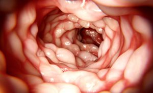sangue nelle feci: gli esami che è necessario fare