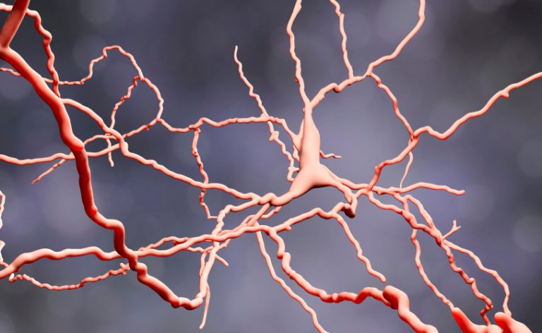 Autismo e schizofrenia: esiste davvero un legame?