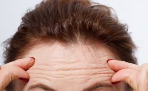 rughe in fronte e problemi cardiaci: il legame