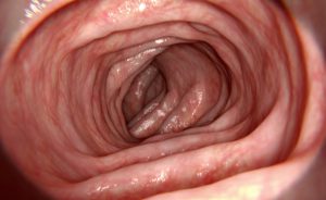 alimentazione e patologie correlate