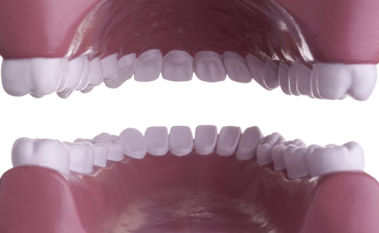 Formicolio al viso, dolore cervicale e intorpidimento: sicuri di masticare bene?