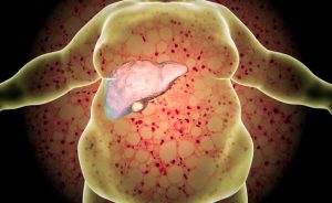 come depurare il fegato: i metodi naturali