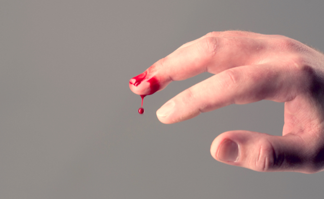 Se vedere sangue ti fa paura, c’è un motivo scientifico