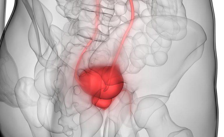 nuove speranza tumore prostata milano en nuove speranza tumore prostata milano en