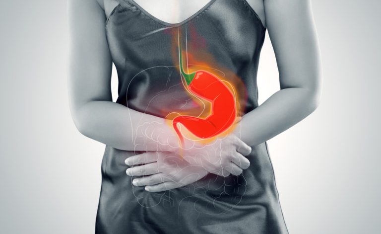 Reflusso gastrico: mai pensato all’osteopatia per alleviare i sintomi?
