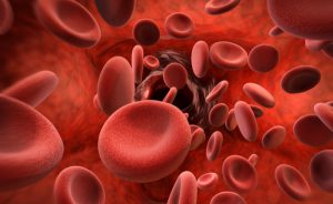trattamento emofilia A con Emicizumab