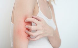 prurito: come combatterlo con la luce