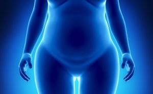 diabete e chirurgia bariatrica: i benefici