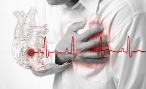 Aspirina per il cuore fa bene o male?