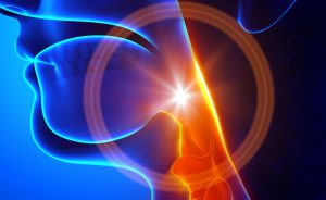 Nodulo gola: terapia per la voce