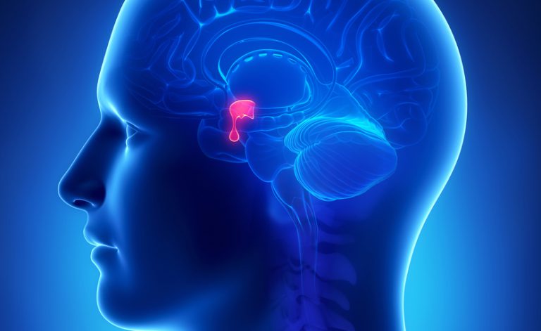 Adenoma all’ipofisi: come riconoscerlo e curarlo (in tempo)
