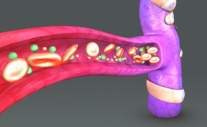 Capillari: cure e tipologie