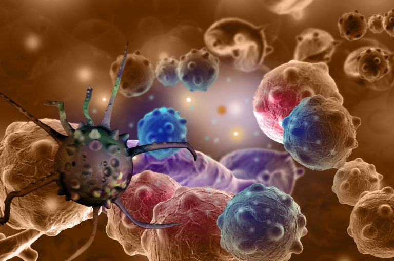 Tumore al colon retto: scoperto un nuovo fattore di rischio
