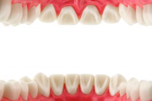 Denti che si muovono: cosa fare?