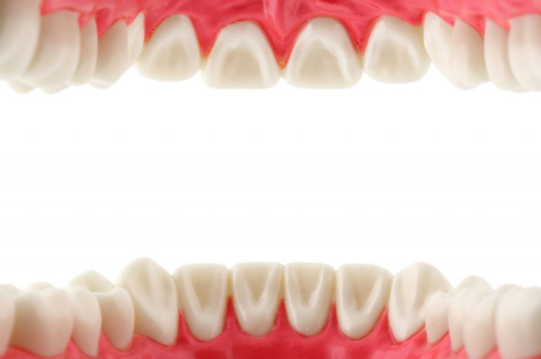 Cosa fare per i denti che si muovono