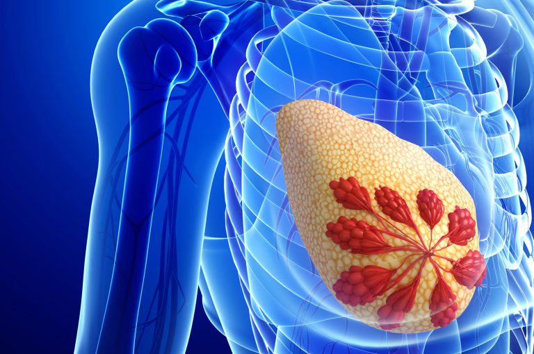 cosa sono le calcificazioni della prostata