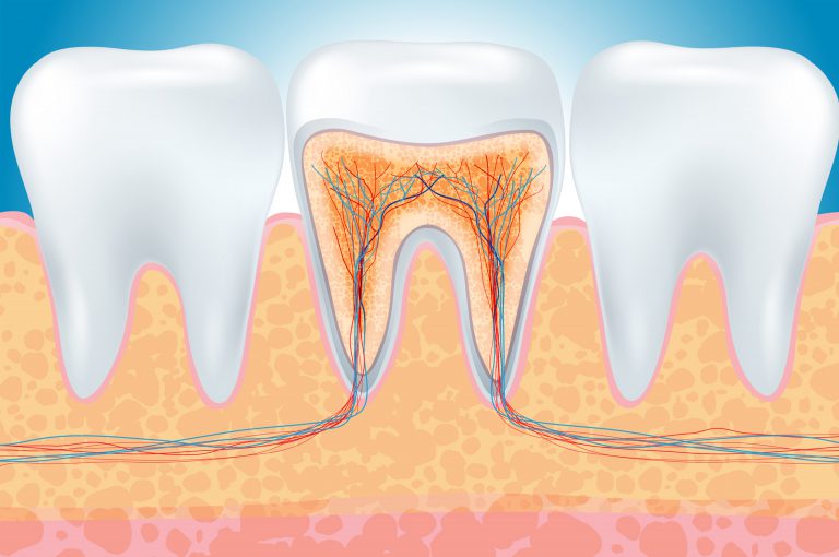 Rimedi naturali contro il mal di denti? Un elenco dei più efficaci