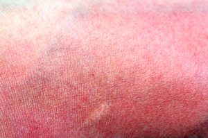 Come applicare la crema solare sul viso